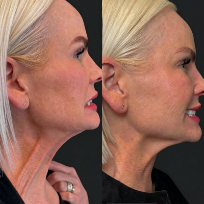 Collagen Retinol Refining Gua Sha Cream
