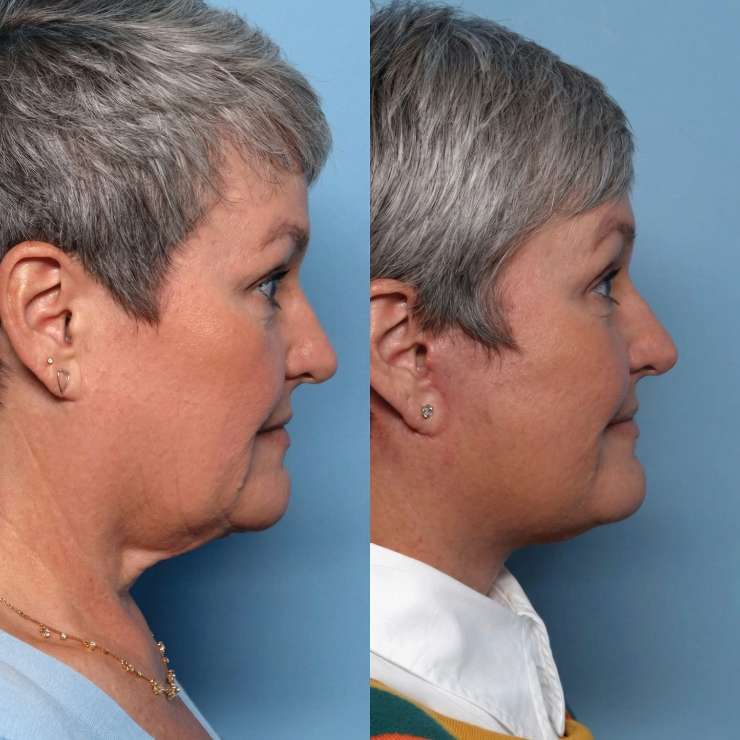 Collagen Retinol Refining Gua Sha Cream